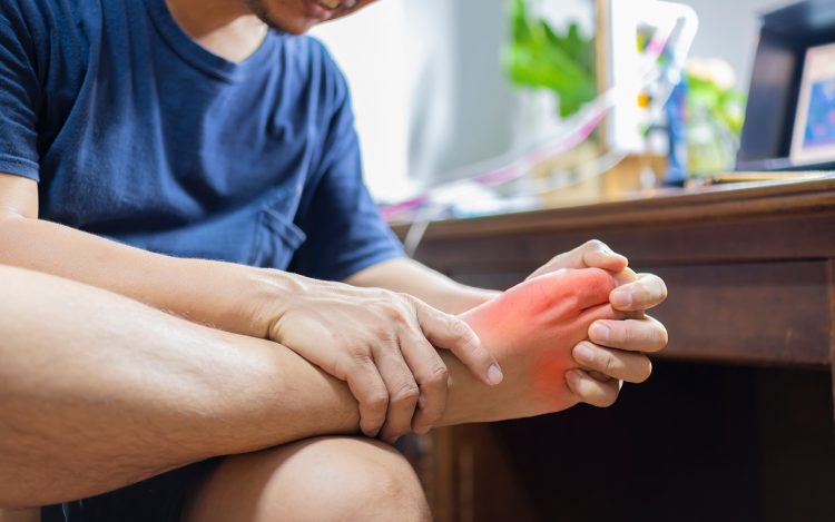 Gout Atau Di Kenal Sebagai Penyakit Asam Urat