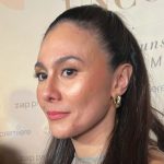 Wulan Guritno Buka Suara Soal Foto Wajah Bopeng Yang Viral