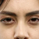 Atasi Mata Panda Secara Alami Menggunakan Bahan Alami