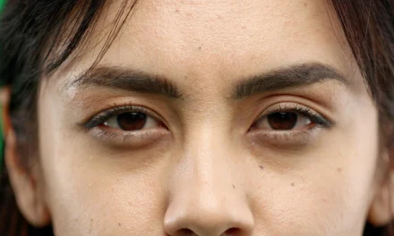 Atasi Mata Panda Secara Alami Menggunakan Bahan Alami