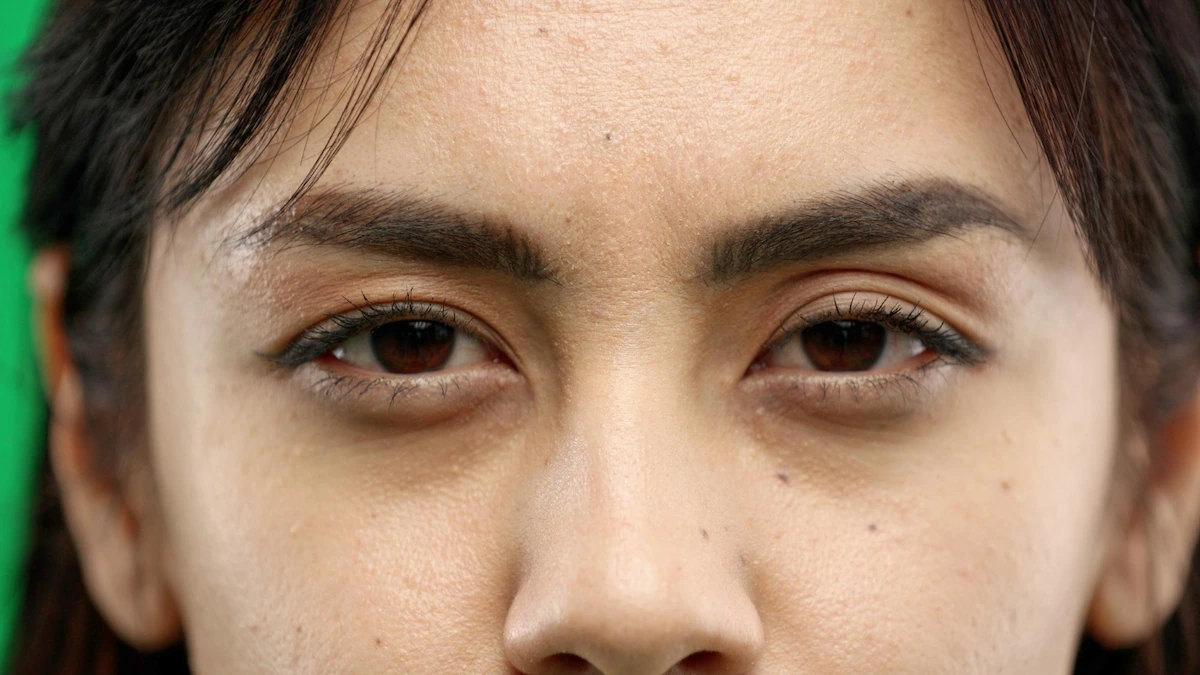 Atasi Mata Panda Secara Alami Menggunakan Bahan Alami