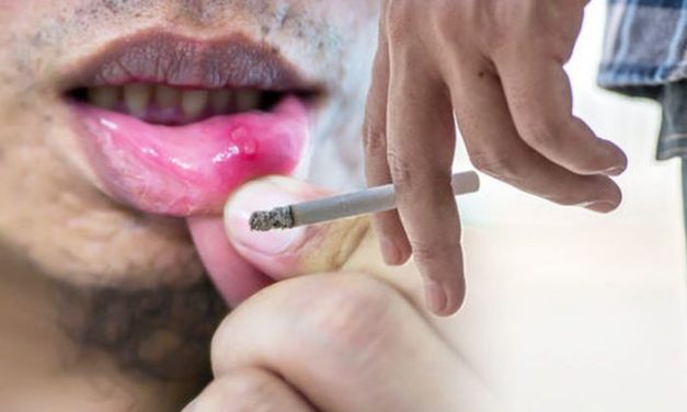 Fakta Menarik Tentang Dampak Merokok Pada Kesehatan Mulut